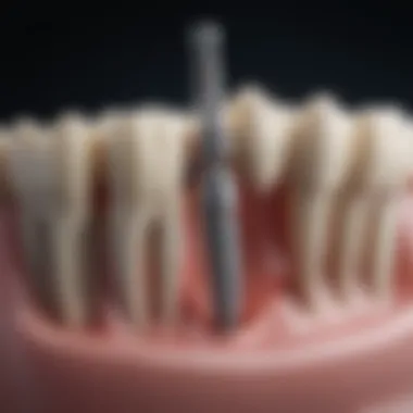 Magnificent Advancements in Dental Implants Through 3D Technology