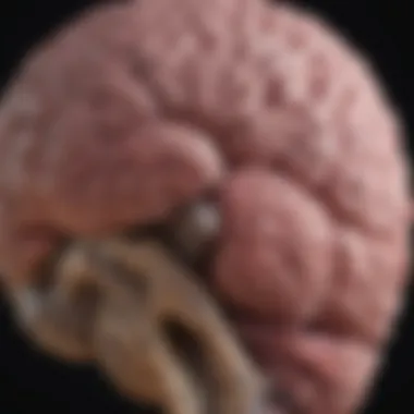 Magnificent Understanding Neurofibromatosis Type 1 and Associated Brain Tumors Magnificent Understanding Neurofibromatosis Type 1 and Associated Brain Tumors