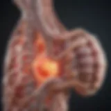 Illustration depicting the pathophysiology of spinal infarction