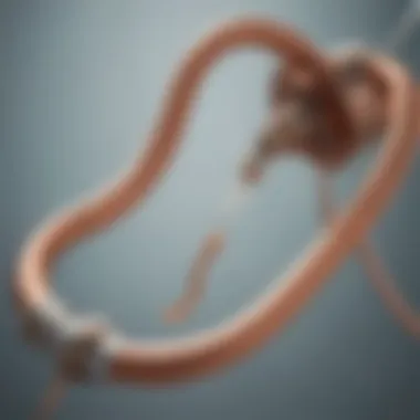 Copper IUD in Position Illustration of copper IUD placement