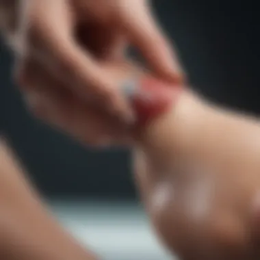 Cortisone Injection Technique Visual representation of cortisone injection procedure