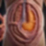 A graphic representation of the colon highlighting areas affected by cancer