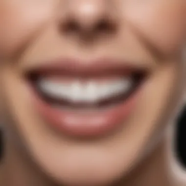 Comparison chart of different teeth whitening systems