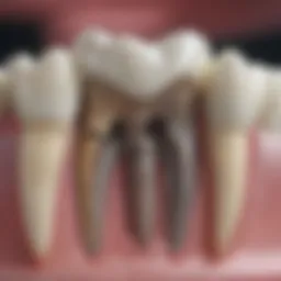 Dental X-ray showing detailed tooth structure