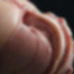 Detailed diagram illustrating KUB ultrasound anatomy