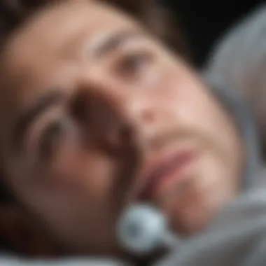 Underdiagnosis Rates in Sleep Apnea Chart analyzing the rates of underdiagnosis in sleep apnea cases
