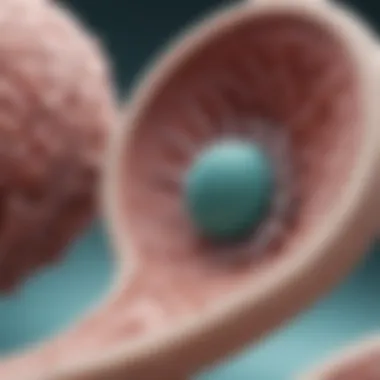 Diagram illustrating the pathophysiology of ovarian cancer