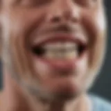 Close-up view of dental splints designed for bruxism relief