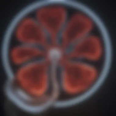 CT scan highlighting the distribution of myeloma