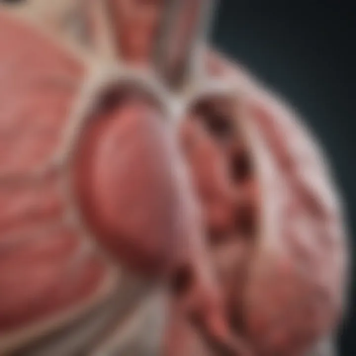 Diagram showing the pathophysiology of stress-induced cardiomyopathy