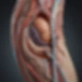Diagram illustrating venous reflux mechanisms in leg veins